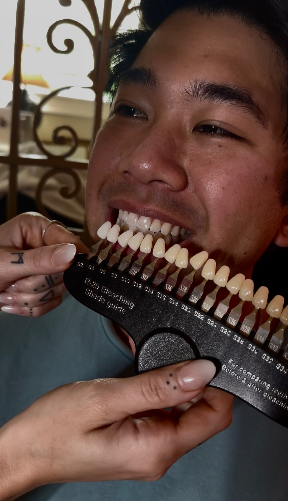 Does Teeth Whitening Hurt?, cover — The Bronze Lily, St. Petersburg, FL