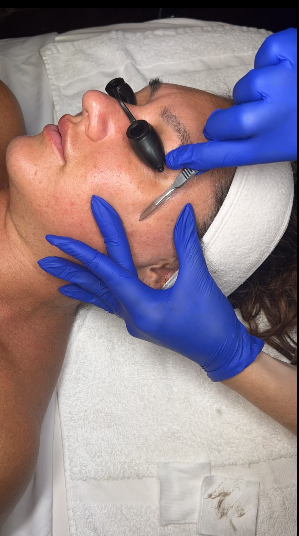 Three paths to smoother skin — The Bronze Lily, St. Petersburg, FL